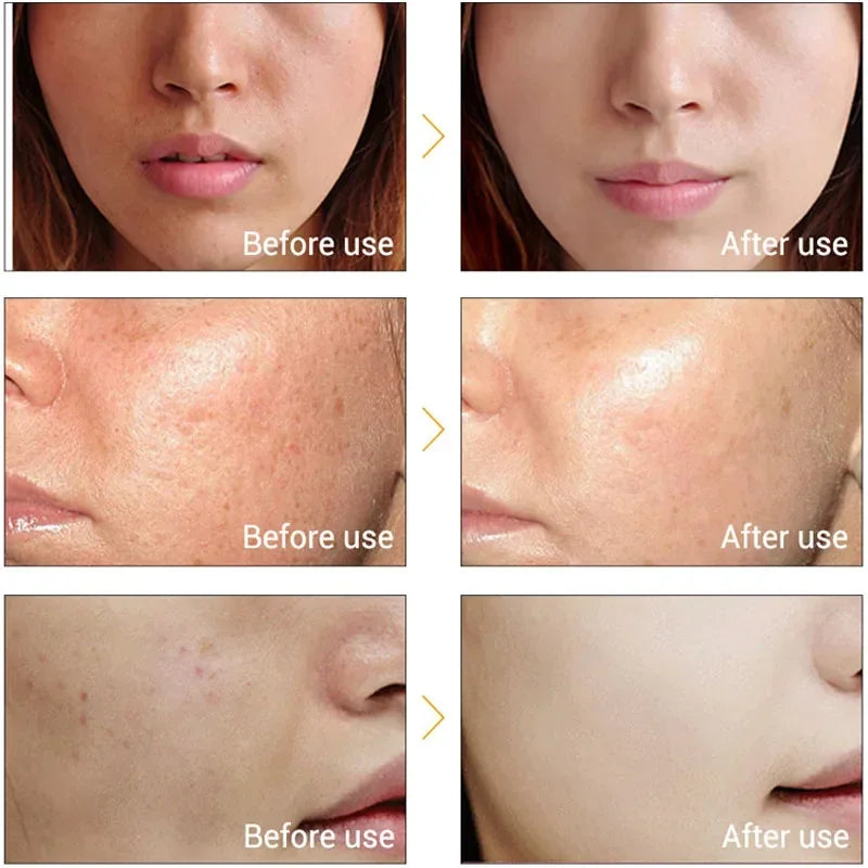 Lifting & Firming Ionic Facial Wand