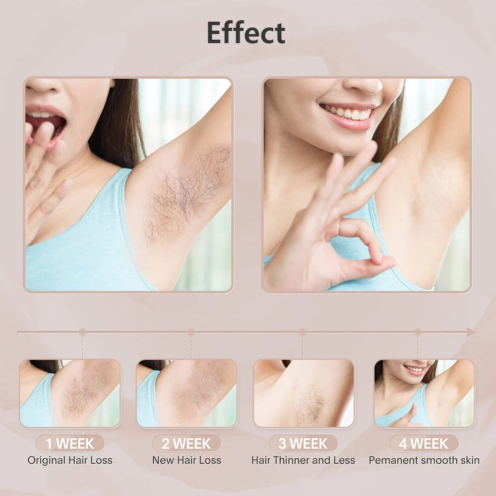IPL Laser Hair Removal Device